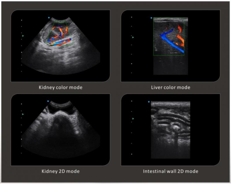 Apogee 2100V Ultrasound M&I Globaltech